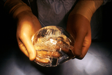 Силиконовый имплант Силиконовый имплант